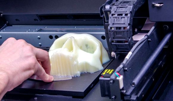 Imprimante 3D în medicină