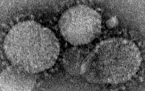Fotografie a microscopului electronic coronavirus MERS CoV