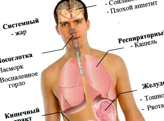 Simptome ale gripei porcine umane