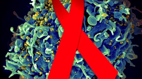 Ce este SIDA și cum să vă protejați de ea