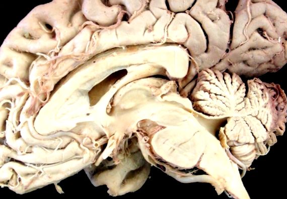 Vedere secțională a unui creier uman real