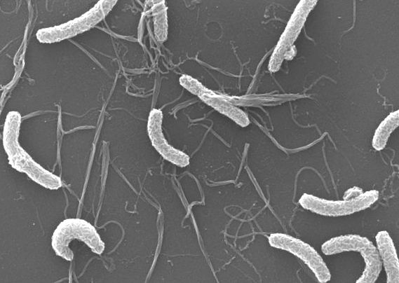 Holeră vibrio Vibrio cholerae la microscop electronic