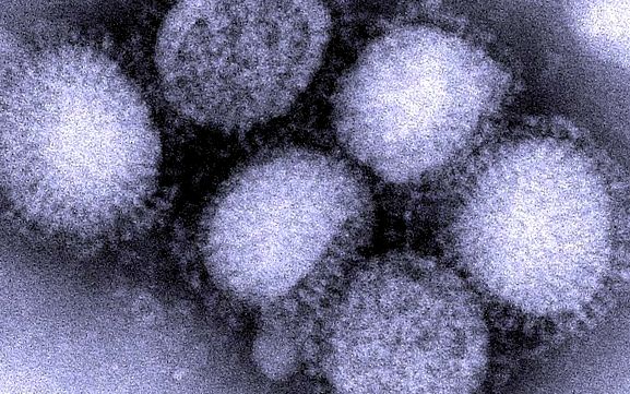 Virusul gripei porcine