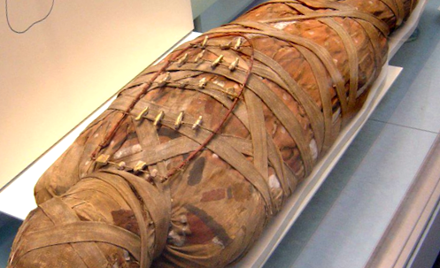 Tumora cancerului la o mumie