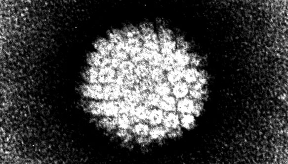 Papilomavirus uman sub microscop electronic