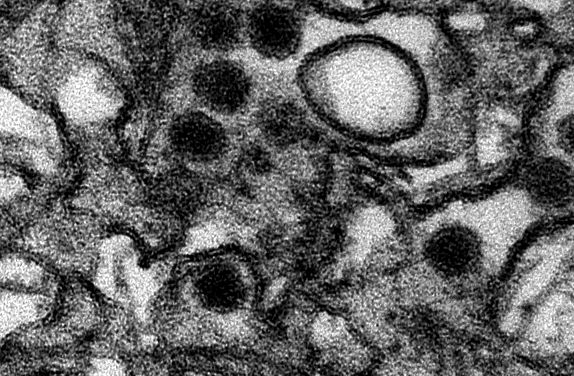 Virusul Zika la microscop