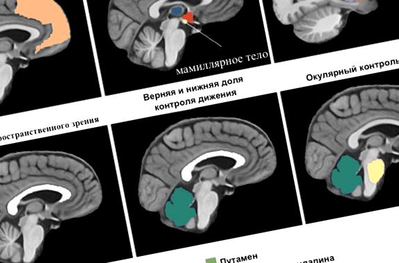 Zonele creierului sub influența alcoolului